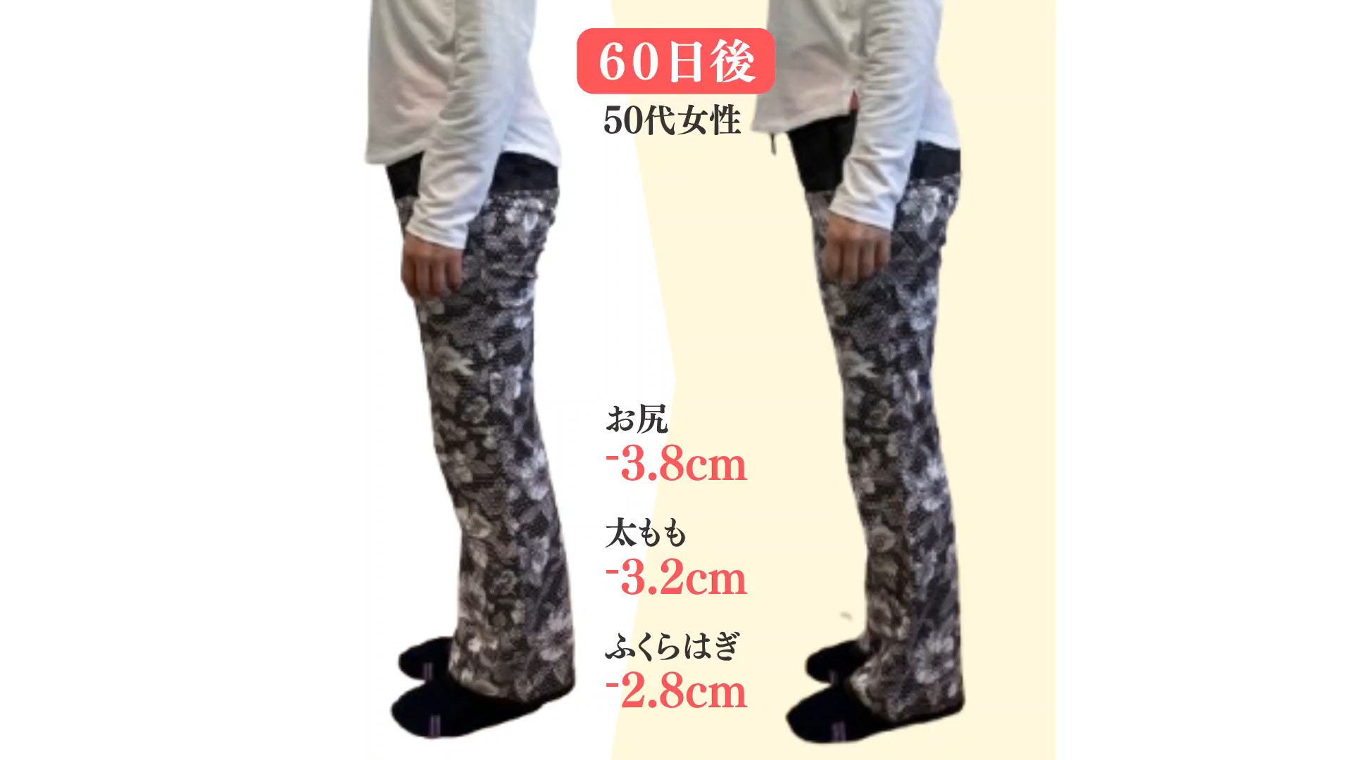 50代ヒップアップビフォーアフター！おしり「たるみ」改善