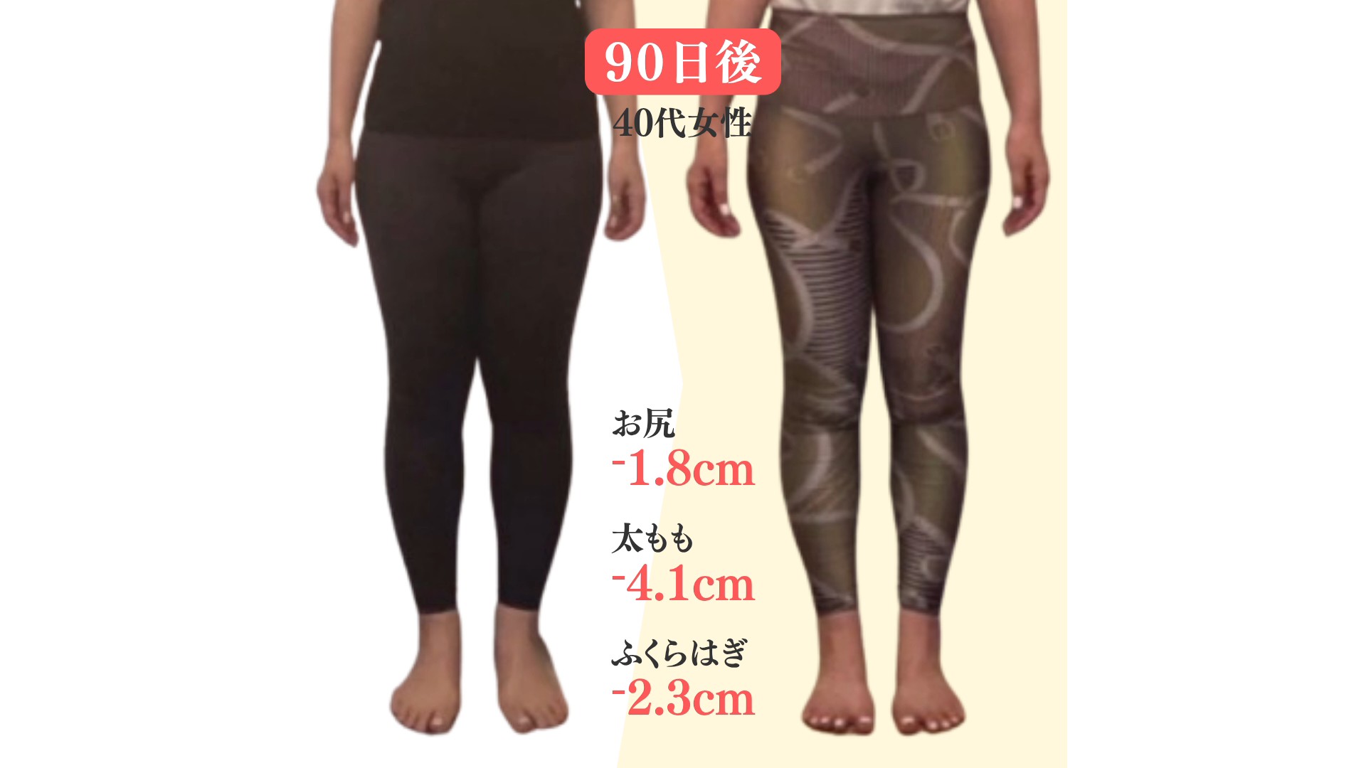 ヒップアップ４０代ビフォーアフター！おしりの「たるみ」改善